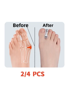 4pcs Magnetiniai Kojų Separatorius Pėdų Priežiūros Raštas Silikono Kojų Ortopedijos Gaminių Guz Korektorius Hallux Valgus Už Pedikiūro Nuotrauka